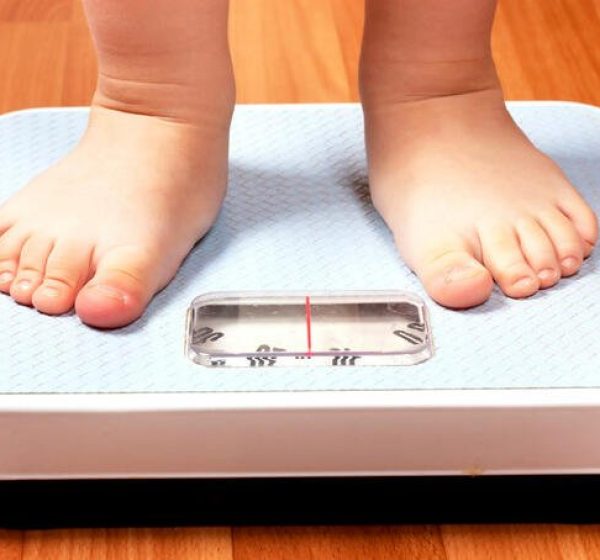 Obesidade infantil já supera a fome e preocupa especialistas