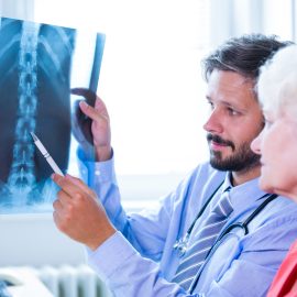 Tratamento da osteoporose exige abordagem integrada