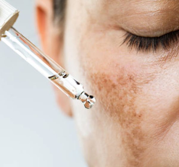 Excesso de produtos de skincare pode causar “burnout da pele” e outros danos, alerta especialista