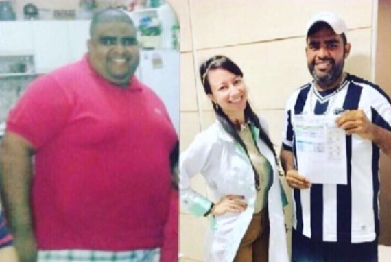 Antes e Depois Junior Bandeira: à direta, Júnior com obesidade mórbida. À esquerda, Júnior com a nutricionista Raquel pessoa. 