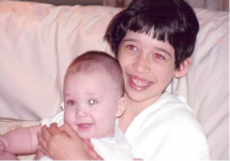 Figura 1: Fotografia com flash mostrando bebê com reflexo vermelho alterado (branco) no olho esquerdo e garoto com reflexo vermelho normal em ambos os olhos. (Foto: reprodução site da SBOP)