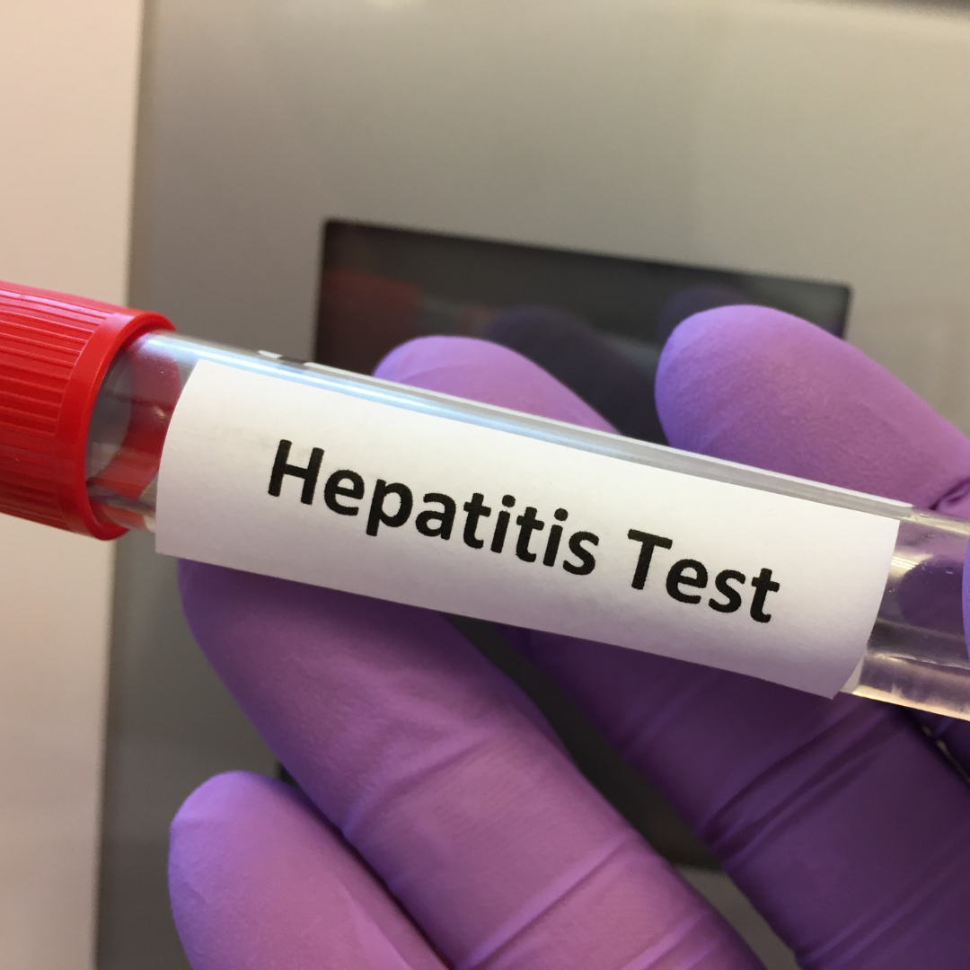 Prefeitura de Fortaleza oferece testes de hepatites nos postos de saúde. (Foto: Canva Pro). 